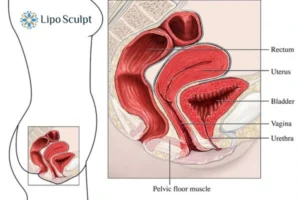 Treatment For A Leaky Bladder 2 How EM Chair treatment Rugby can help Leaky bladder issues. Read more now!