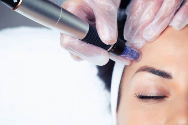 Explaining Total Skin Tightening Treatment and What to Expect 2 What Skin Concerns Can Total Skin Tightening Treatment Help With Rugby?